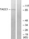 Transforming Acidic Coiled-Coil Containing Protein 1 antibody, TA314585, Origene, Western Blot image 
