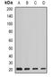 Anterior Gradient 2, Protein Disulphide Isomerase Family Member antibody, abx141951, Abbexa, Western Blot image 