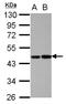 Protein C, Inactivator Of Coagulation Factors Va And VIIIa antibody, LS-C155242, Lifespan Biosciences, Western Blot image 