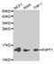 14 kDa phosphohistidine phosphatase antibody, MBS127383, MyBioSource, Western Blot image 