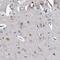 Galactosidase Beta 1 Like 3 antibody, NBP2-48716, Novus Biologicals, Immunohistochemistry paraffin image 