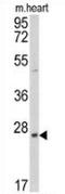 Protein Tyrosine Phosphatase 4A3 antibody, AP15252PU-N, Origene, Western Blot image 