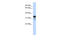 Regulator Of Microtubule Dynamics 1 antibody, 26-113, ProSci, Enzyme Linked Immunosorbent Assay image 