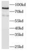 Tax1 Binding Protein 1 antibody, FNab08506, FineTest, Western Blot image 