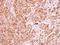 Cholinergic Receptor Nicotinic Beta 1 Subunit antibody, LS-C155371, Lifespan Biosciences, Immunohistochemistry paraffin image 