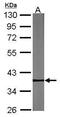 Pygopus Family PHD Finger 2 antibody, PA5-34878, Invitrogen Antibodies, Western Blot image 