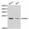 RAB4A, Member RAS Oncogene Family antibody, A11143, ABclonal Technology, Western Blot image 