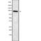 ADAM Metallopeptidase Domain 23 antibody, abx147979, Abbexa, Western Blot image 