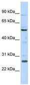 Homeobox C5 antibody, TA345263, Origene, Western Blot image 