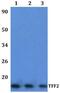 Trefoil Factor 2 antibody, PA5-75918, Invitrogen Antibodies, Western Blot image 