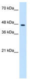 Zinc Finger Protein 213 antibody, TA339090, Origene, Western Blot image 
