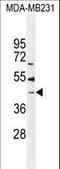 Beta-1,4-Galactosyltransferase 6 antibody, LS-C156720, Lifespan Biosciences, Western Blot image 