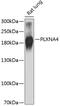 Plexin A4 antibody, 24-017, ProSci, Western Blot image 