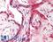 ElaC Ribonuclease Z 2 antibody, LS-B15863, Lifespan Biosciences, Immunohistochemistry paraffin image 