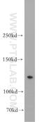 CANP antibody, 20552-1-AP, Proteintech Group, Western Blot image 