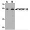 Transmembrane Protein 135 antibody, MBS153691, MyBioSource, Western Blot image 
