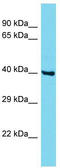 Coiled-coil domain-containing protein 86 antibody, TA331750, Origene, Western Blot image 
