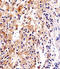 Fc Fragment Of IgE Receptor Ig antibody, MBS9203246, MyBioSource, Immunohistochemistry frozen image 