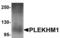 Pleckstrin Homology And RUN Domain Containing M1 antibody, TA306873, Origene, Western Blot image 