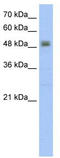 Radical S-Adenosyl Methionine Domain Containing 2 antibody, TA329507, Origene, Western Blot image 