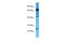 Charged Multivesicular Body Protein 4B antibody, ARP53339_P050, Aviva Systems Biology, Western Blot image 