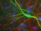 Neurofilament Heavy antibody, NBP1-05215, Novus Biologicals, Immunofluorescence image 