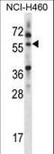 Multiple Inositol-Polyphosphate Phosphatase 1 antibody, LS-C164199, Lifespan Biosciences, Western Blot image 