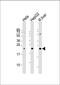 Tetraspanin 31 antibody, GTX81157, GeneTex, Western Blot image 