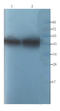 Alpha-1-antitrypsin antibody, orb339609, Biorbyt, Western Blot image 