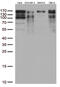 La Ribonucleoprotein Domain Family Member 1 antibody, M04488, Boster Biological Technology, Western Blot image 