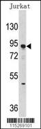 DNA Methyltransferase 3 Alpha antibody, 55-138, ProSci, Western Blot image 