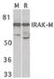 Interleukin 1 Receptor Associated Kinase 3 antibody, orb87326, Biorbyt, Western Blot image 