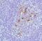 Syndecan 1 antibody, MA5-16331, Invitrogen Antibodies, Immunohistochemistry paraffin image 