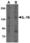 Interleukin 16 antibody, A01635-1, Boster Biological Technology, Western Blot image 