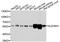 Aldehyde Dehydrogenase 6 Family Member A1 antibody, STJ26234, St John