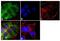 Parathyroid Hormone 1 Receptor antibody, GTX79394, GeneTex, Immunofluorescence image 