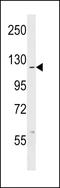 ABL Proto-Oncogene 1, Non-Receptor Tyrosine Kinase antibody, LS-C99160, Lifespan Biosciences, Western Blot image 