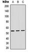 ADAM Like Decysin 1 antibody, orb234996, Biorbyt, Western Blot image 