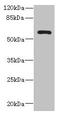 Zinc Finger CCHC-Type Containing 4 antibody, CSB-PA887984LA01HU, Cusabio, Western Blot image 