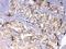 Argininosuccinate Lyase antibody, A00742-1, Boster Biological Technology, Immunohistochemistry paraffin image 