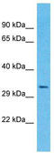 Olfactory Receptor Family 4 Subfamily A Member 16 antibody, TA337500, Origene, Western Blot image 