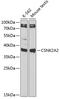 Casein Kinase 2 Alpha 1 antibody, 15-012, ProSci, Western Blot image 