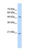 Glucosaminyl (N-Acetyl) Transferase 4 antibody, orb325329, Biorbyt, Western Blot image 