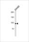 Anoctamin 6 antibody, 60-953, ProSci, Western Blot image 