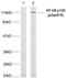 Nuclear Factor Kappa B Subunit 2 antibody, PA5-37663, Invitrogen Antibodies, Western Blot image 