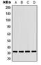 Programmed Cell Death 1 antibody, MBS821930, MyBioSource, Western Blot image 