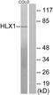 H2.0 Like Homeobox antibody, GTX87590, GeneTex, Western Blot image 