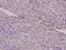 Aurora Kinase B antibody, A00762Y8, Boster Biological Technology, Immunohistochemistry paraffin image 