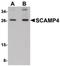 Secretory Carrier Membrane Protein 4 antibody, PA5-20787, Invitrogen Antibodies, Western Blot image 
