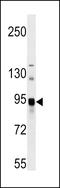 N-Acylsphingosine Amidohydrolase 2 antibody, LS-C159128, Lifespan Biosciences, Western Blot image 